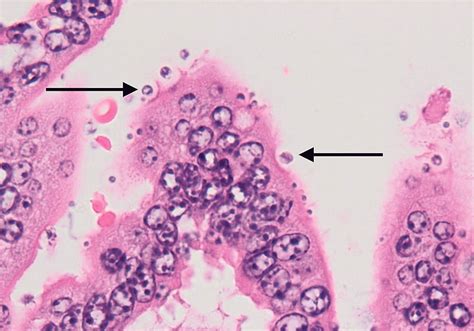  Kryptosporidium! Ett mikroskopiskt övervuxet parasit som koloniserar tarmens slemhinna