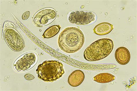  Mikrosporidier –  En mikroskopisk värld av parasiter som invaderar alla möjliga värdorganismer!