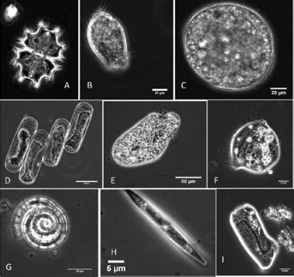  Vorticella! En Mikroskopisk Virvelvind som Fängslar Plankton med Dess Häpnadsväckande Tentakler